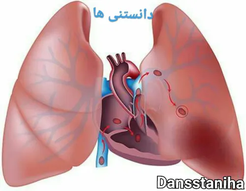 در بدن انسان ریه ی سمت راست هوای بیشتری از ریه ی سمت چپ م