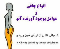 اگه فرم بدنت اینجوریه،،احتمالا گردش خونت مشکل داره!ژ