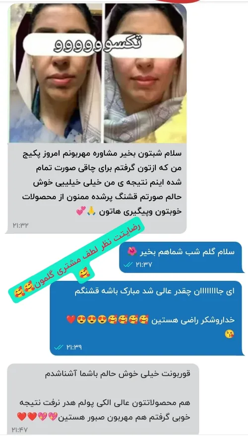 رضایتتت از پکیج چاقی صورت خدایا شکرتتت😍😍😍😍😍