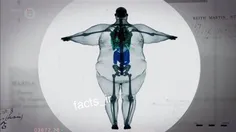 اشعه ایکس از یک مرد 410 کیلو گرمی😱