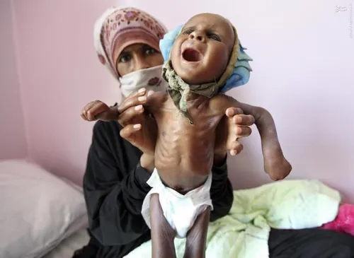 حقوق بشر برای این کودکان یمنی هم هست؟