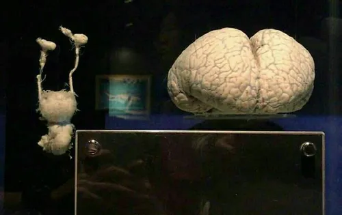 مغزه دلفین (سمت راست)