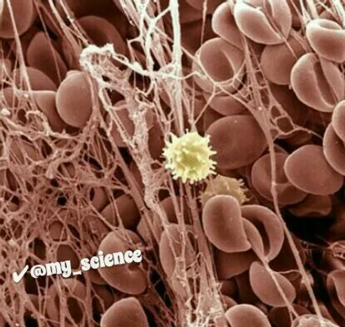 تصویر میکروسکوپی از خون لخته شده....