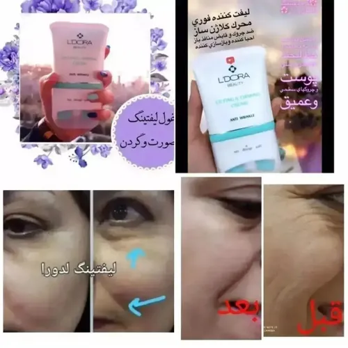 🌱🌱😍کرم لیفتینگ صورت و گردن ماساژوردار لدورا