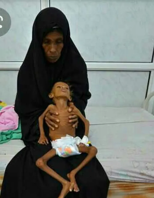 کاش یمن کودک نداشت ..