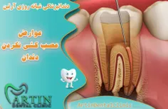 عوارض عصب کشی نکردن دندان 