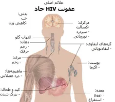 تصویر نیم‌تنه انسان که در آن شایع‌ترین علائم ابتلای حاد ب