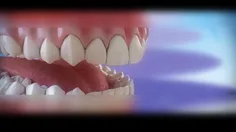 مراحل انجام ارتودنسی دندان 