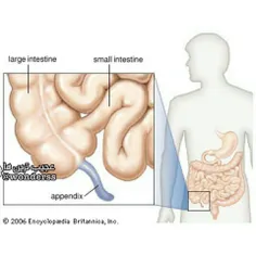 برعکس تصور اکثر مردم، آپاندیس عضو اضافی و بی فایده ای نیس