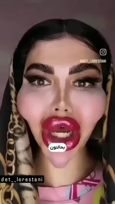 از چشمام به خاطر دیدن همچین اسیدی معذرت می‌خوام😑🗿