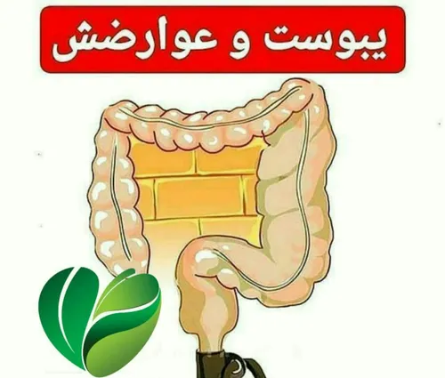 ✅ یبوست ( مادر تمام بیماریها )