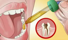 چطوری درد دندون رو ازبین ببریم؟🤔 