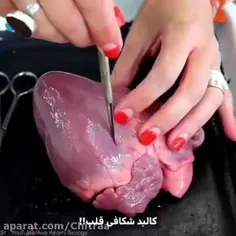 کالبدشکافی قلب