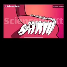 دندان عقل (Wisdom tooth) آخرین دندان انسان در هر قوس فکی،