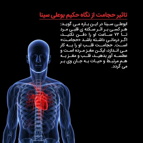 تاثیر حجامت از نگاه حکیم ابوعلی سینا : هر کسی بر اثر سکته