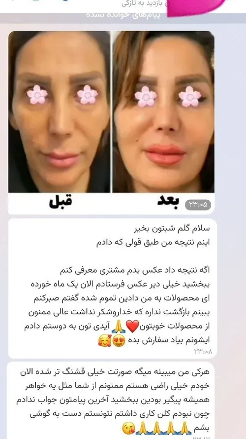 رضایت مشتری گلمون از پکیج چاقی صورت خدایا شکرتتتتتت 😍😍😍🥰🥰