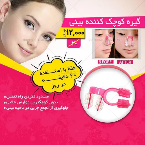 گیره کوچک کننده بینی(قیمت:12هزارتومان+۷ت هزینه ی پست درب 