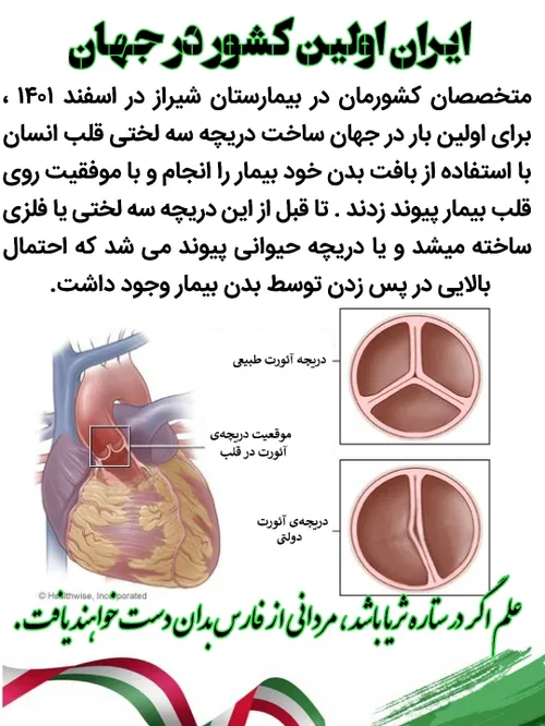 دریچه قلب عمل جراحی قلب قلب شیراز فناوری ایران قوی ستاره 