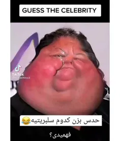 منو بگو چقد بهش خندیدم😟😩😫