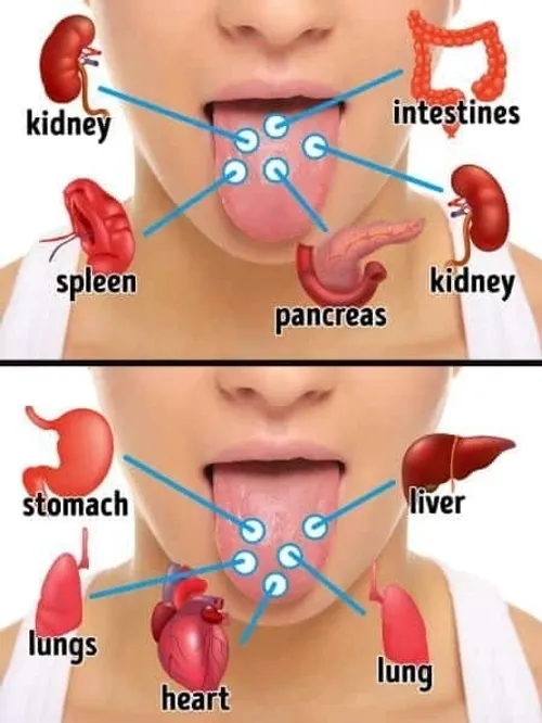 نقش زبان شناسی در طب سنتی