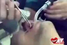 دانلود کلیپ بیرون آوردن آچار از دهان یک مرد توسط پزشکان
