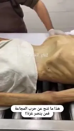 این پیرمرد فلسطینی دیروز از شدت گرسنگی جان باخت ..