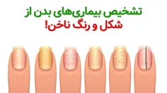 📌سلام دوستان در خدمت تون هستم با مبحث ناخن شناسی 💅