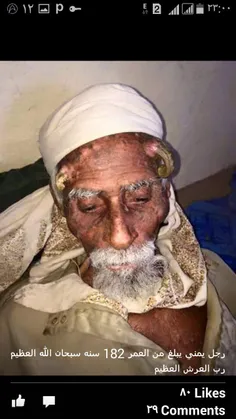 مرد یمنی در سن 182 سالگی شاخ دراورد