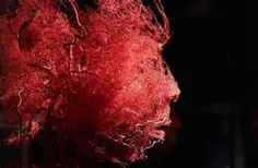 شبکه شریانی(سرخرگی) صورت انسان