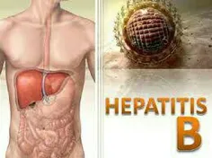 نشانه های شایع ابتلا به هپاتیتB :