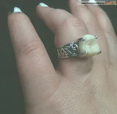 حلقه ازدواج ک از دندان عقل همسر درست شده