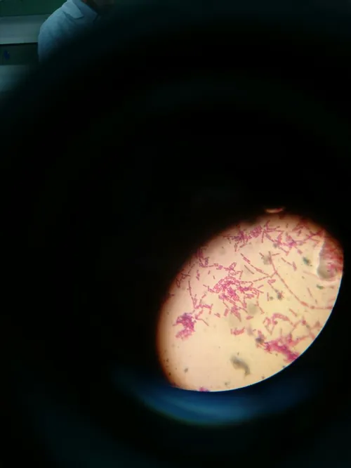 باکتریهایی که زیرمیکروسکوپ دیدم ...