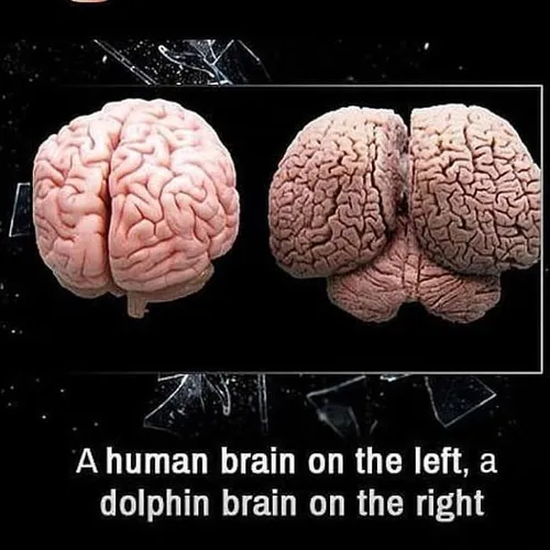 سمت چپ: مغز انسان