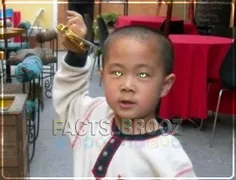 پسر چینی که با چشمان آبی روشن متولد شده، قادر است اجسام ر