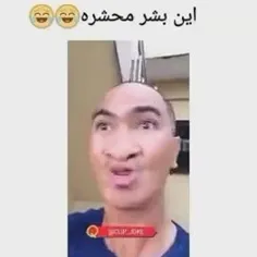 دزدگیر زنده😂