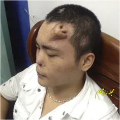 این مرد چینی پس از یک حادثه رانندگی دچار شکستگی بینی شد ط
