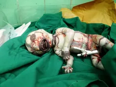 تولد نوزادی وحشت ناک در بیمارستانی در شیراز
