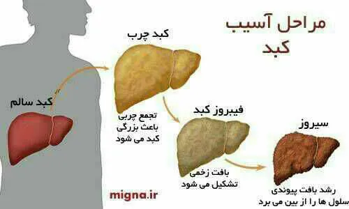 مراحل آسیب کبد پزشکی پرستاری دندانپزشکی