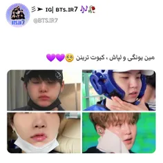 اینم نوعی دیگر از موچی💟💟💟