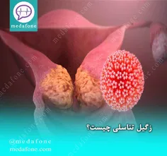 زگیل تناسلی 👩‍⚕️دکتر احیا خان احمدی