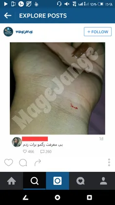 ببین بی معرفت رگشو زده..