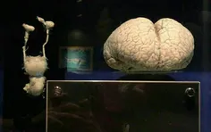 مغزه دلفین (سمت راست)