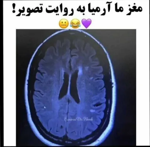 دقیقا😂😂