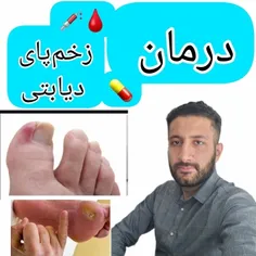 زخم پای دیابتی