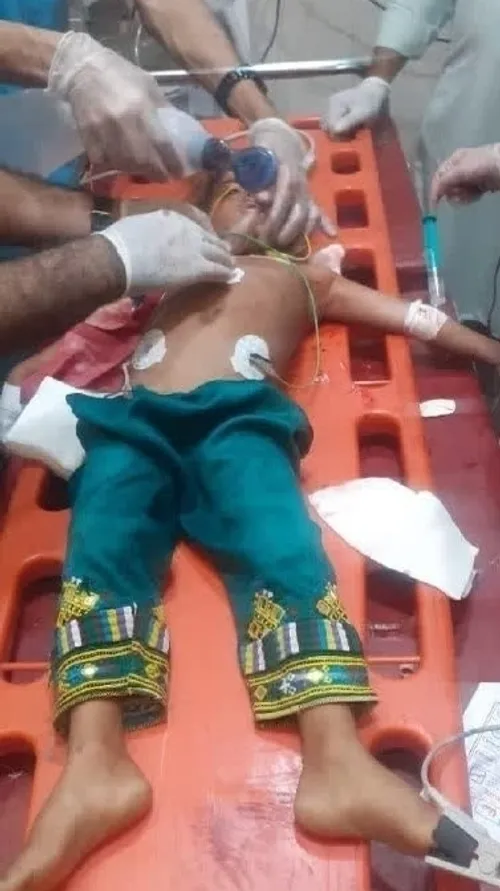 این تصویر کودک بلوچی است که در حملات تروریستی دیشب جیش ال