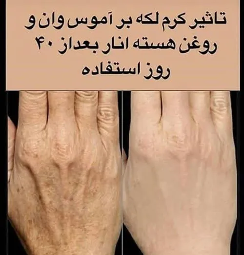 آموس وان زیبایی پوست تندرستی نتیجه