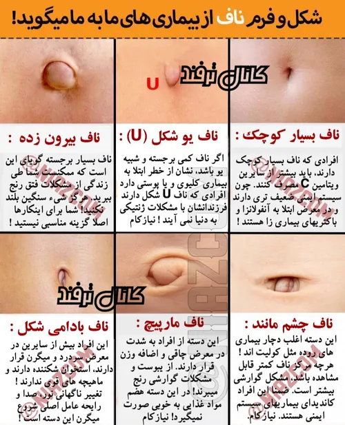 آنچه شکل و فرم ناف از بیماریهای شما میگوید