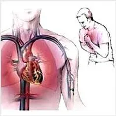 مراقبت ها و احتیاط های پس از جراحی قلب :
