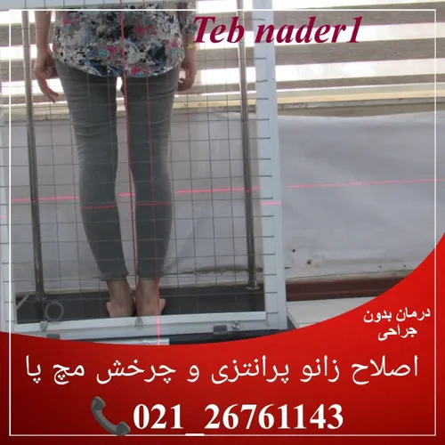  tebnader5522856 66819029 - عکس ویسگون