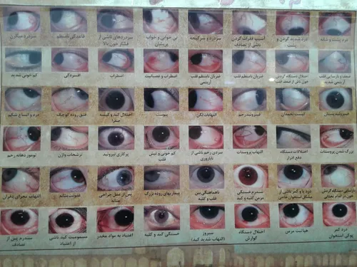 بیماریها از روی ظاهر چشم